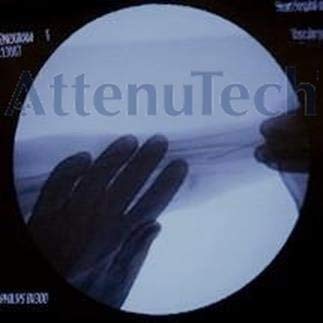 Radiation Reducing X-Ray Hand Cover - Sterile & Latex Free - for Radiation Interventional Medicine Safety 8.0