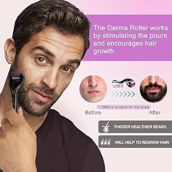  [AUSTRALIA] - Derma Roller 540 Titanium Micro Needling for Face and Body-Face Roller for Skin Rejuvenation Anti Ageing Scar Acne marks Cellulite Treatment-Beard Roller for Hair Growth for Men and Women (1.5 mm) 1.5 mm