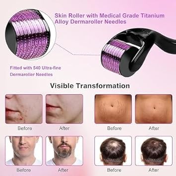  [AUSTRALIA] - Derma Roller 540 Titanium Micro Needling for Face and Body-Face Roller for Skin Rejuvenation Anti Ageing Scar Acne marks Cellulite Treatment-Beard Roller for Hair Growth for Men and Women (1.5 mm) 1.5 mm