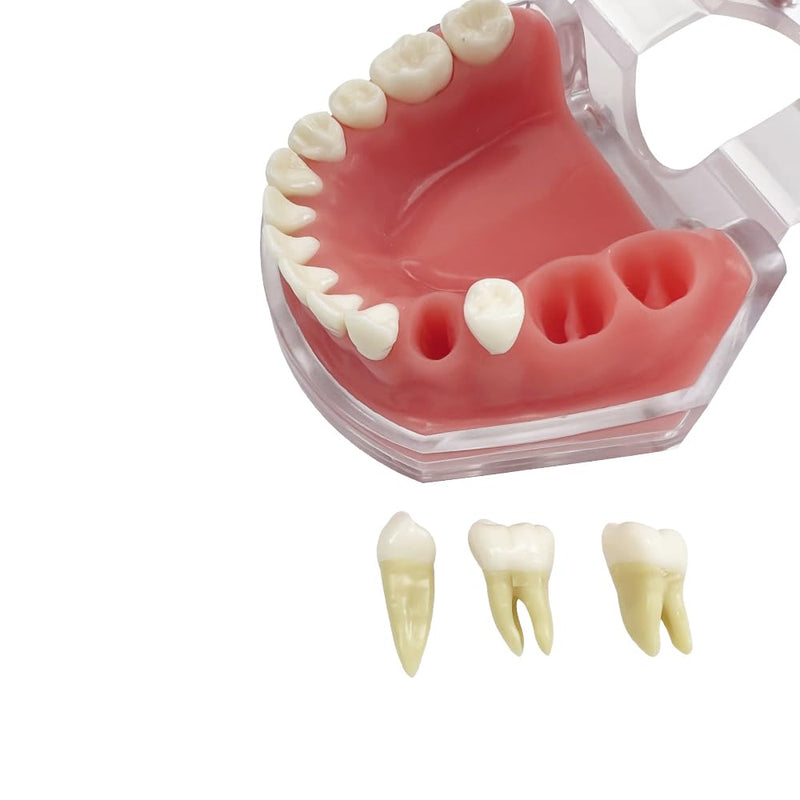 Standard Dental Demonstration, YOUYA DENTAL Teeth Model Teaching Model Study Tool Soft Gums Teaching Dental Mode with 28 Removable Teeth Red Gum-28 removable