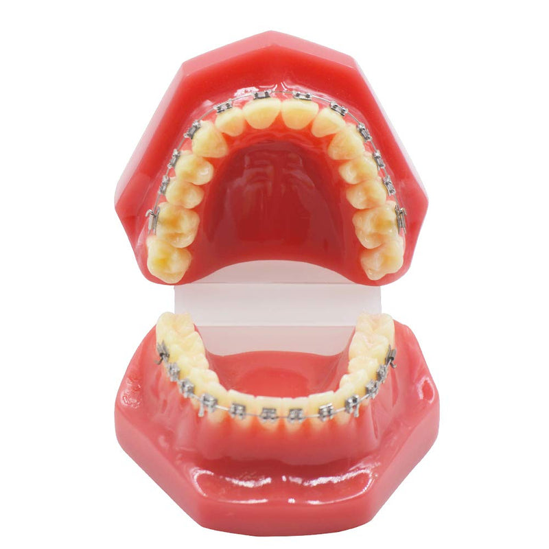 Dental Orthodontic Metal Brcket with Typodont Teeth Model