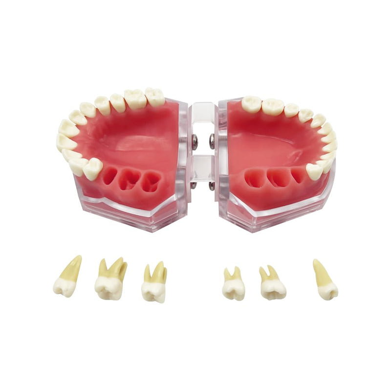 Standard Dental Demonstration, YOUYA DENTAL Teeth Model Teaching Model Study Tool Soft Gums Teaching Dental Mode with 28 Removable Teeth Red Gum-28 removable