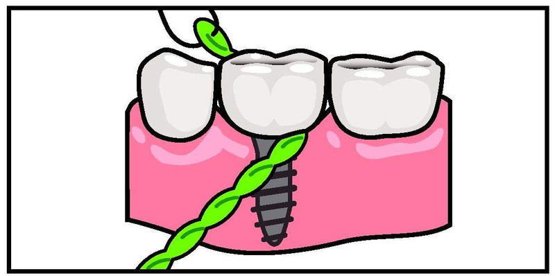 IDontix Brace X-Floss, Green