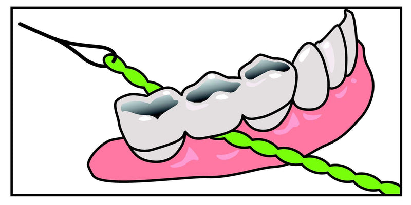 IDontix Brace X-Floss, Green