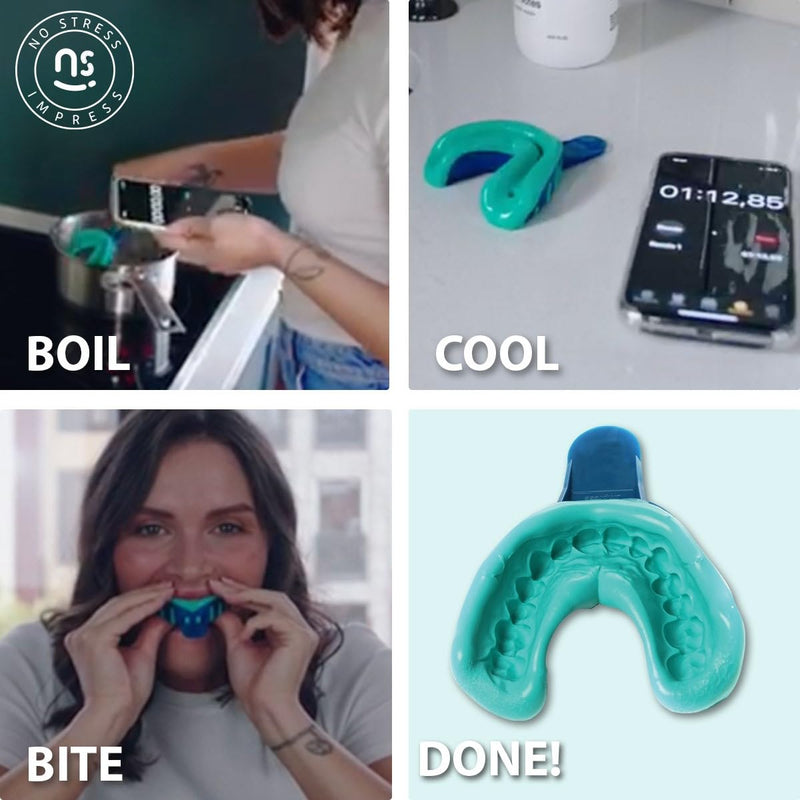No Stress Impress™ One-Step Pre-Loaded Boil & Bite Dental Impression Kit – Easy At-Home Teeth Impression Trays