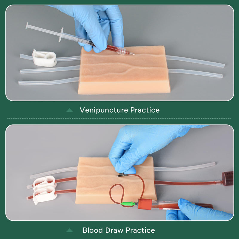 Ultrassist IV Injection Practice Kit, Venipuncture & IV Insertion Training Set, Phlebotomy Practice Simulator for Nursing Students Educational Use Only