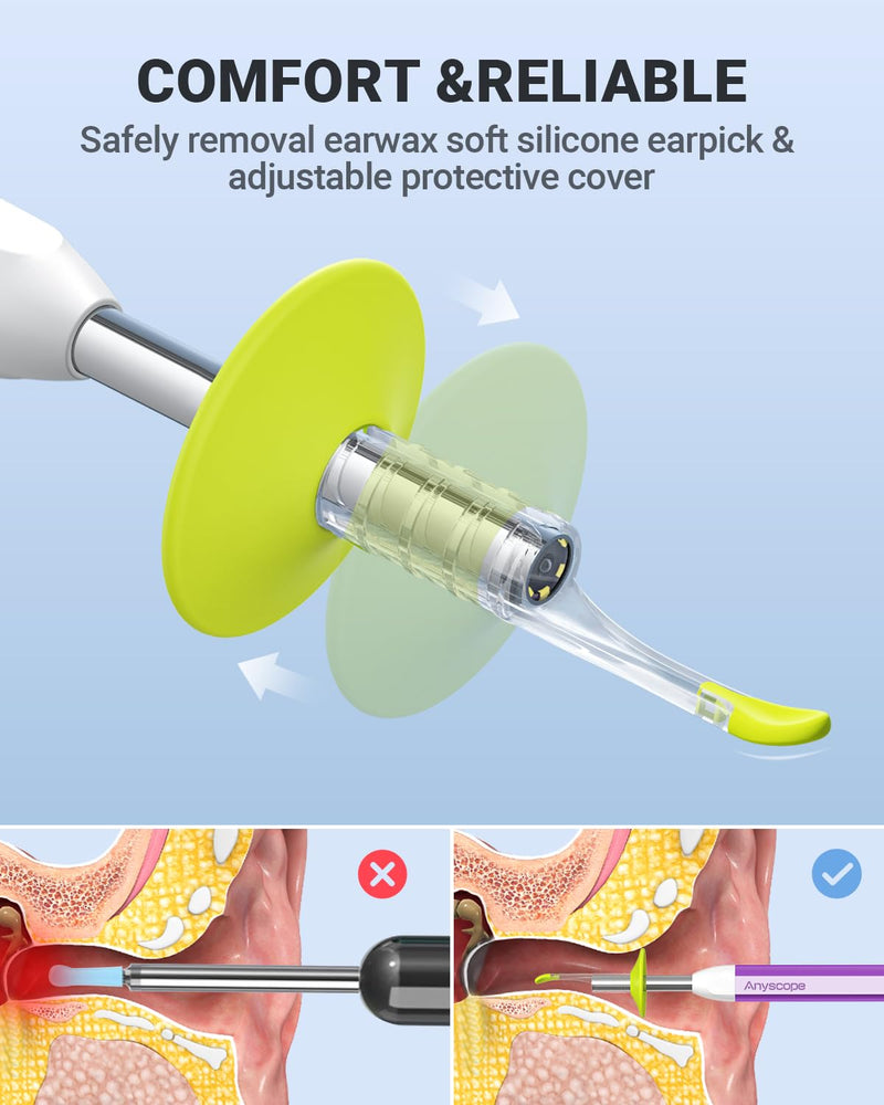 Digital Otoscope with Gyroscope, HD Ear Camera with Ear Wax Removal Tools, Video Ear Scope Otoscope with Light, Compatible with iPhone and Android (Purple) Purple