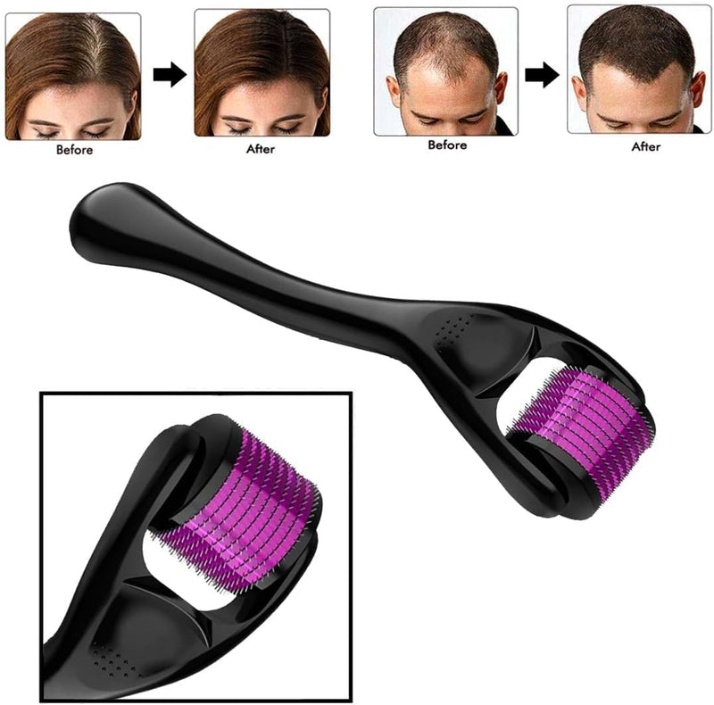 Derma Roller for Hair Growth Women and Men, Scalp Dermaroller for Skin Care, Skin Rejuvenation, Scar Removal, 540 Titanium Microneedling Face Toning Device for Skin (Derma 0.75 MM) 0.75mm