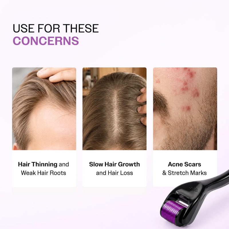Bare Anatomy Derma Roller for Hair Growth | 0.25 mm with 540 Titanium Micro Needles | Stimulates Hair Follicles & Improves Scalp Circulation