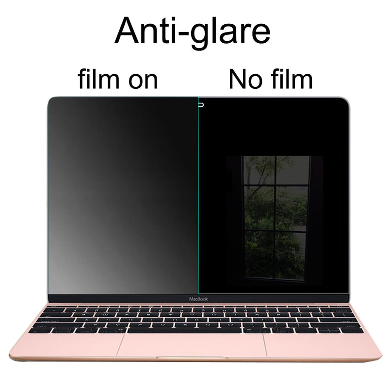 360 Degree Matte Privacy Screen Protector for MacBook Pro 14 inch (M3, M2, M1, Pro, Max, 2021-2023) Anti-Glare Anti-Spy 4 Sides Anti-Peeping Soft Film