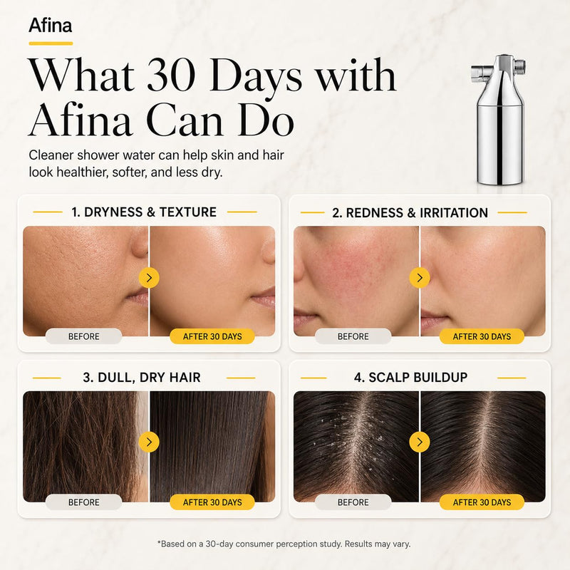 Afina Chrome High Pressure Revitalizing Shower Filter - Filter Out Chlorine | Reduces Dry Itchy Skin, Dandruff & Flaky Scalp; Improves Skin, Hair & Nails