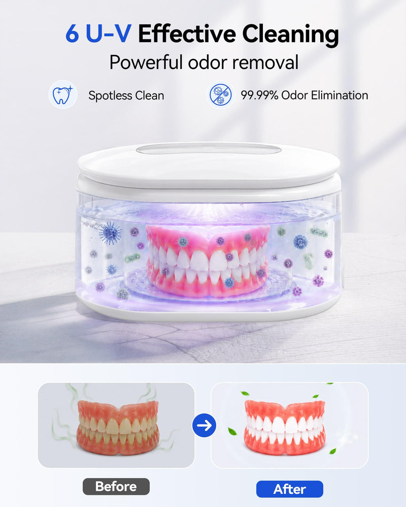Miorcols Ultrasonic Jewelry Cleaner, Ultrasonic Cleaner Machine with Digital LED Display, 20oz 304 Stainless Steel Tank for Jewelry, Eyeglasses, Watches, Dentures, Retainers & More - White