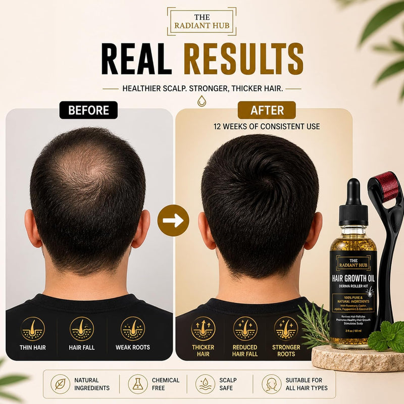 Rosemary Oil for Hair Growth & Derma Roller Kit - Castor, Jojoba, Peppermint & Coconut Oils for Thicker Stronger Hair, Stimulates Scalp & Revives Follicles - For Men & Women - 60 ml