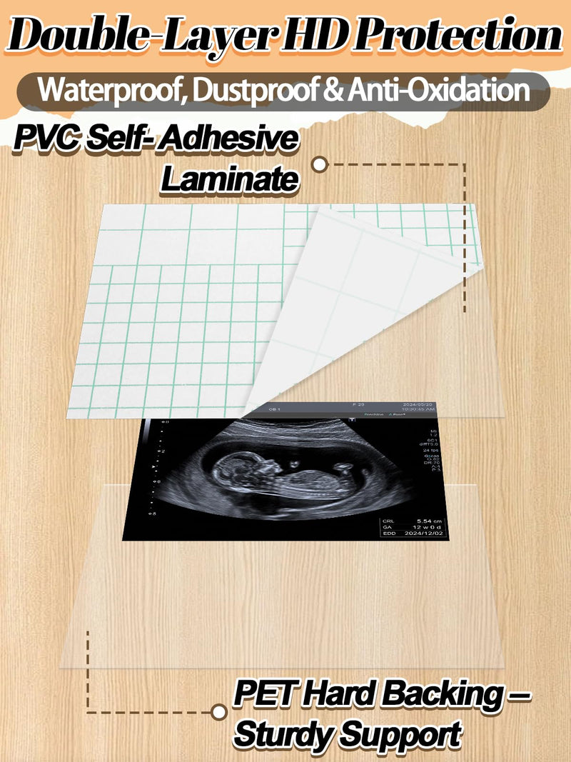 20 Sets User-Friendly Laminating Sheets for 3x4/4x6in Ultrasound Pictures | Keep Baby Sonogram Picture/Special Memories Safe, Pregnancy Journal Must Haves, Pregnancy Gifts for Expecting Mom