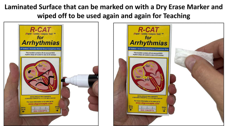 R-CAT for Arrhythmias EKG Pocket Reference Guide – Contains Literally Every EKG Rhythm Known - Great Study Booklet for EKG Interpretation - Cardiac Rhythm Interpretation Made Easy