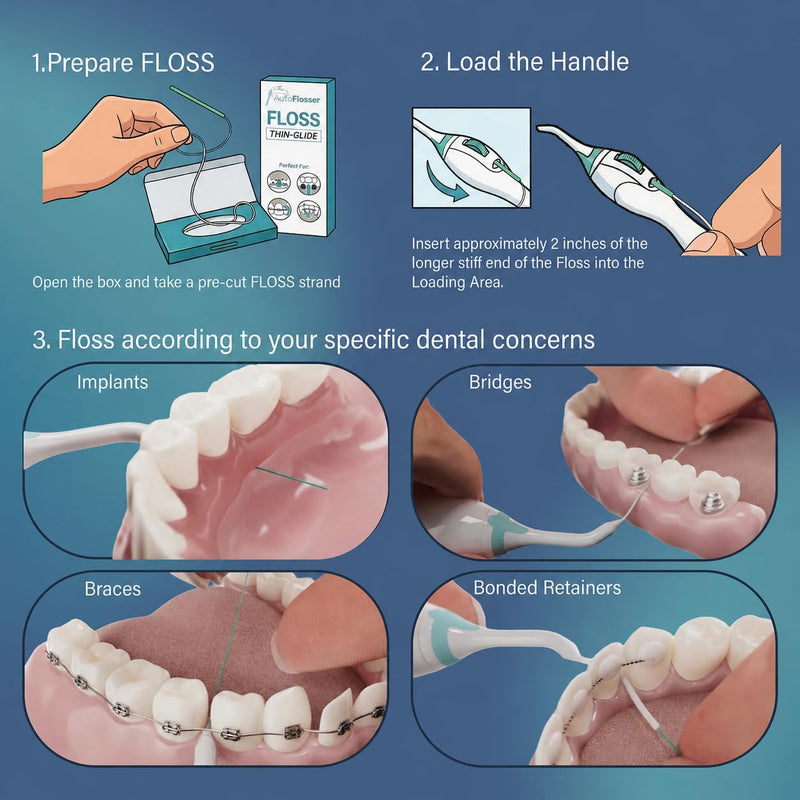 The AutoFlosser Dental Floss Threader Handle Kit for Bridges & Implants | Refillable Flosser for Bridges, Bonded Retainers, Dentist Designed Ergonomic Handle, 2 Tips, 30 Thin-Glide Strands