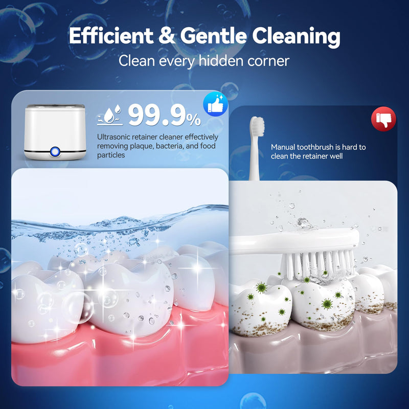 Miorcols Ultrasonic Retainer Cleaner Machine, 48kHz Denture Cleaner Machine for Mouthguard, Braces, Night Guard, Toothbrush, Jewelry with 7.8OZ Dental Cleaning Pod- White