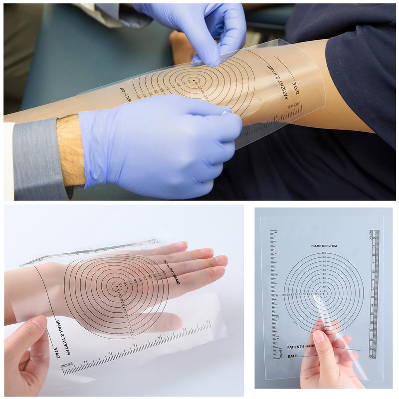 Motiskyy 300 Pack Wound Measurement Tools Measuring Bullseye Guide Medical Wound Ruler Soft Flexible Measure Guide for Nurses Patient