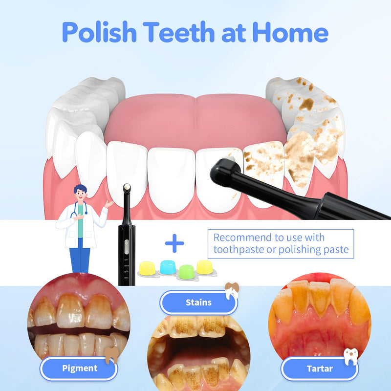Electric Tooth Polisher, Plaque Remover for Teeth Whitening, Teeth Polishing Kits 4 Speed Modes，Rechargeable Dental Polisher for Cleaning, Waterproof Tooth Polish Tools with 5 Brush Heads& LED Light