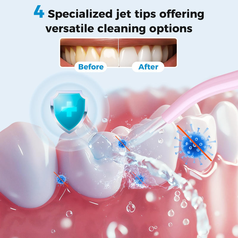 LINKEVAP Water Flosser for Teeth Pick,360ML Rechargeable Travel Oral Irrigator Cleaner,IPX7 Waterproof Daily Dental Care Machine for Home (Pink) Pink
