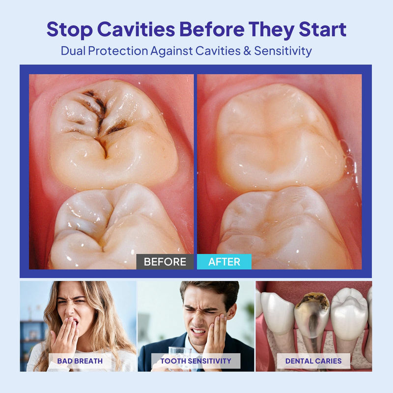 Cavity Healing Tooth Armor Liquid: Clinically Strengthen Enamel with Remineralization Drops at-Home Tooth Enamel Repair Stronger Teeth Hydroxyapatite (120ml, Mint) 4 Fl Oz (Pack of 1)
