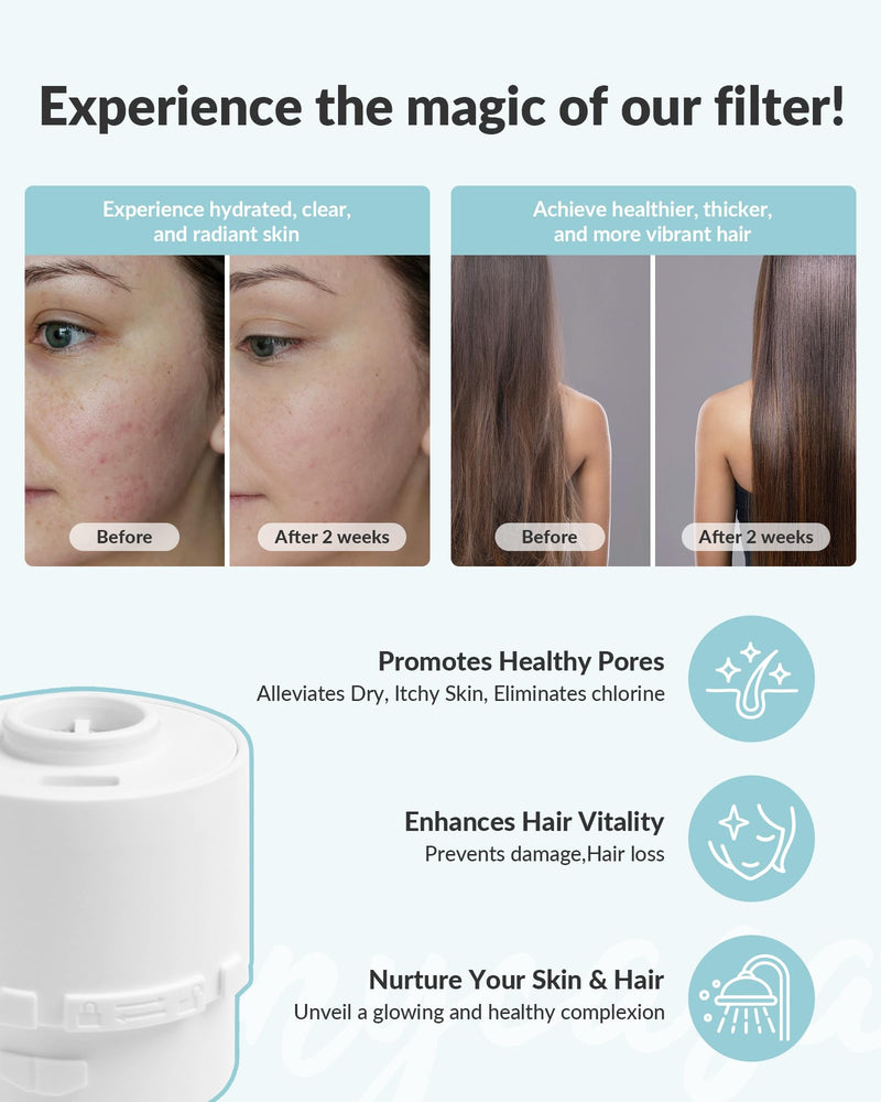 SANYCASA Shower Filter for SANYCASA Beauty Shower Head, KDF-55 Filter Dermatologist Recommended for Softening Hard Water, Improves Hair & Skin 1