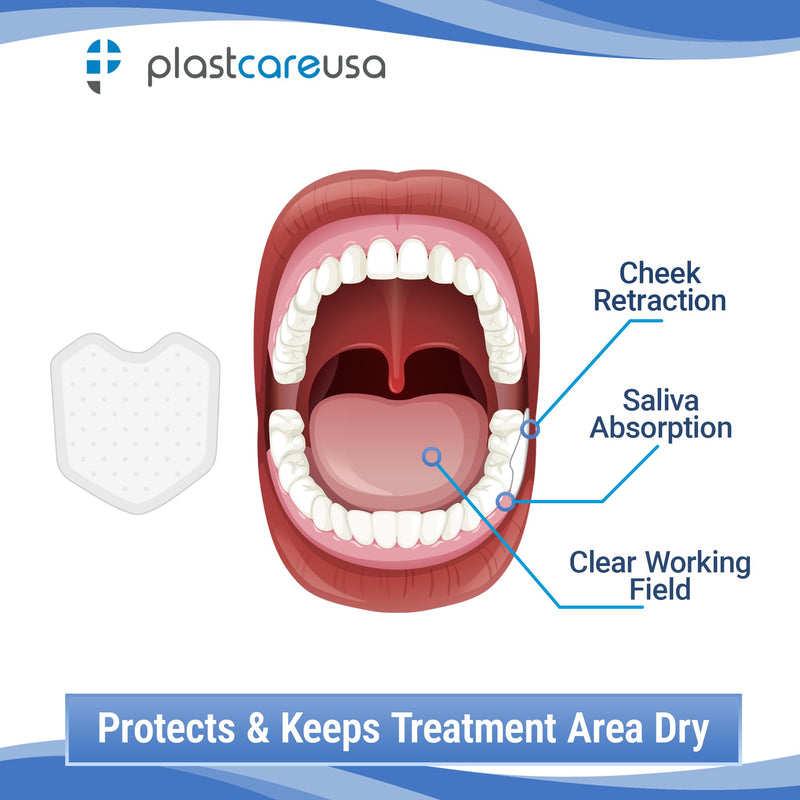 200 Dental Dry Corners, Disposable Saliva Control & Cheek Protection Pads Super Absorbent Non-Woven Padding (Cotton Roll Alternative) (Large) Large