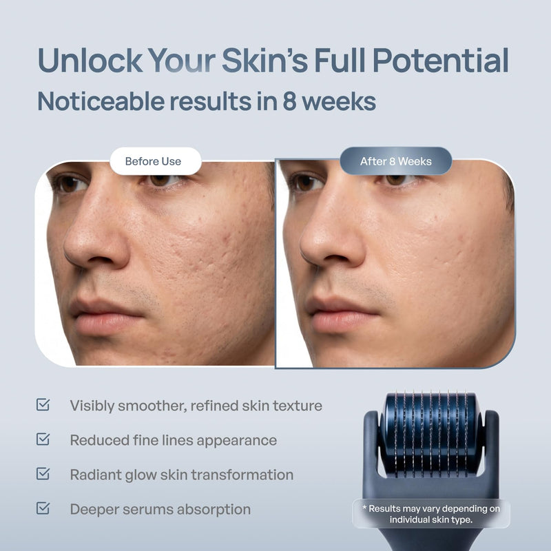 PLANTIFIQUE Derma Roller for Hair Growth & Skin Renewal, Grey | Microneedling Face Roller, 0.25mm Titanium Fine Needles, Includes Protective Case