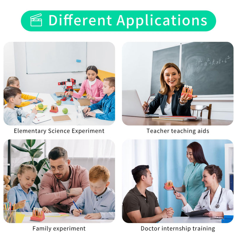 Annhua 4 Times Dental Implant Teeth Model Analysis Crown Bridge Demonstration Model, Dental Teeth Crown Roots Removable for Education, Patients Communication, Learning and Lab