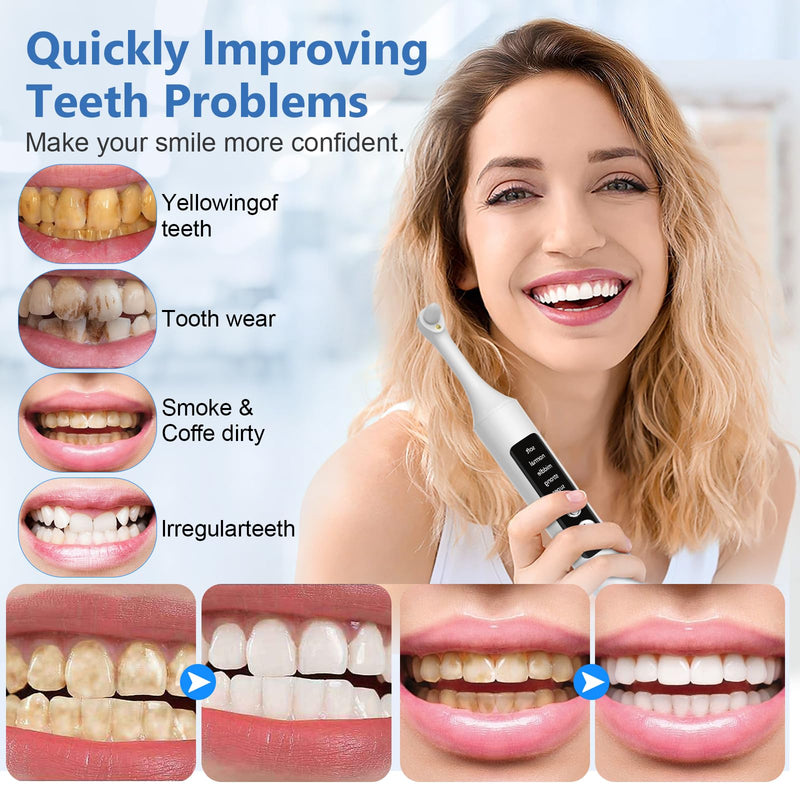 Teeth Whitening Polisher Kit, Rechargeable Dental Polisher for Teeth Cleaning and Whitening, Electric Teeth Polisher Tool with LED Light, 6 Brush Heads 5 Speed Modes for Home and Travel Use