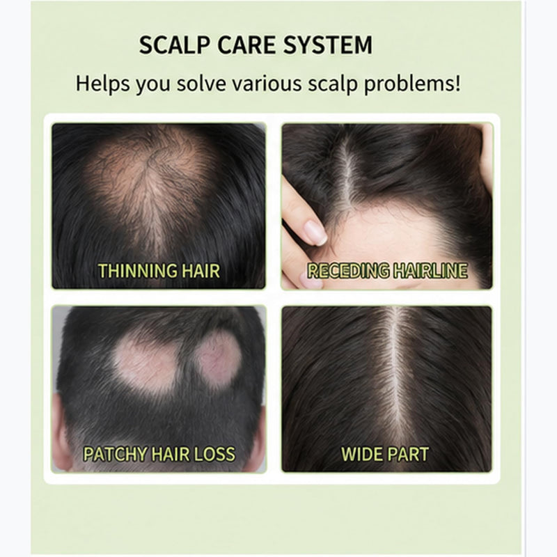 Hair Regrowth System with Micro-Infusion - Hair Density Care Kit | Scalp Serum for Men & Women, Microneedle Hair Roller Set with 2 Rollers & 8 Serums Refills