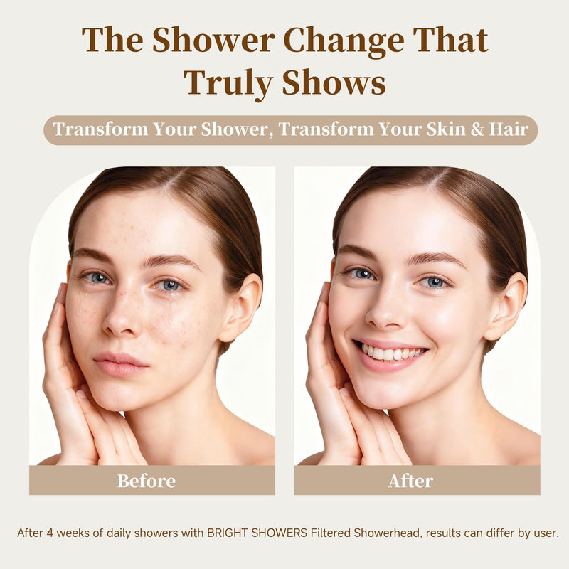 BRIGHT SHOWERS Filtered Shower Head, High Pressure Fixed Showerhead for Hard Water, Dual-Media Filter Removes Chlorine & Impurities, 8 Spray Modes, Oil Rubbed Bronze
