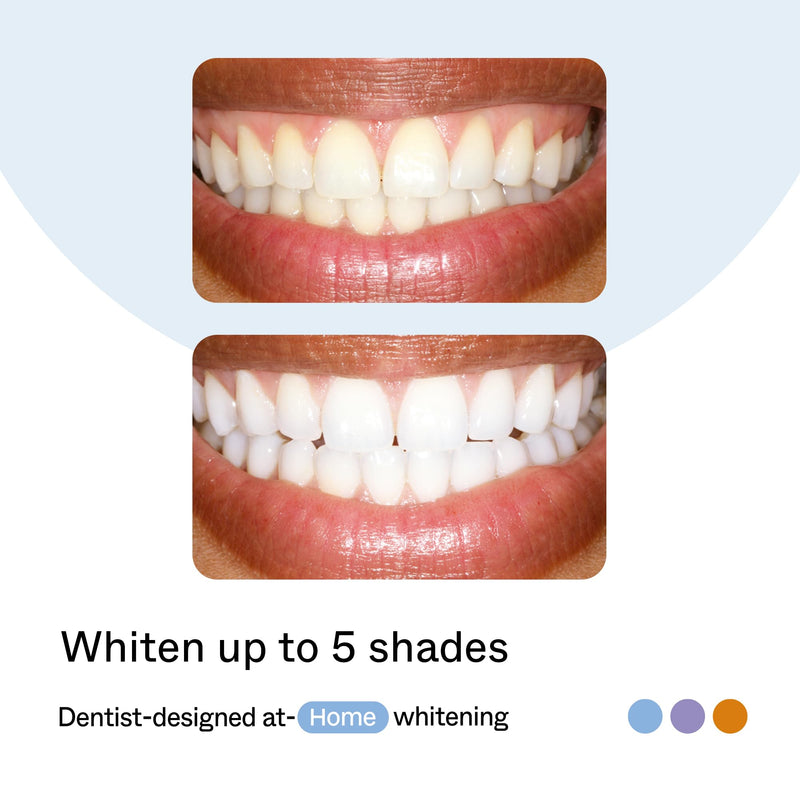 Opalescence GO Home Advanced Teeth Whitening Trays 15% (4 Treatments) Hydrogen Peroxide PF - Whitening Prefilled Kit - Developed by Leaders in Professional Whitening 6006-T Mint 15 1 Count (Pack of 4)