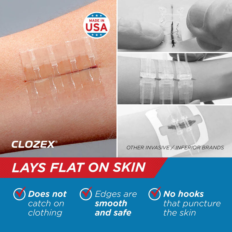 Clozex Emergency Laceration Closures - Repair Wounds Without Stitches, Skin Closure Device for 3 Individual Wounds Or Combine for Total Length of 4 1/4 Inches 3 Closures- 3/4", 1 1/2", 2"