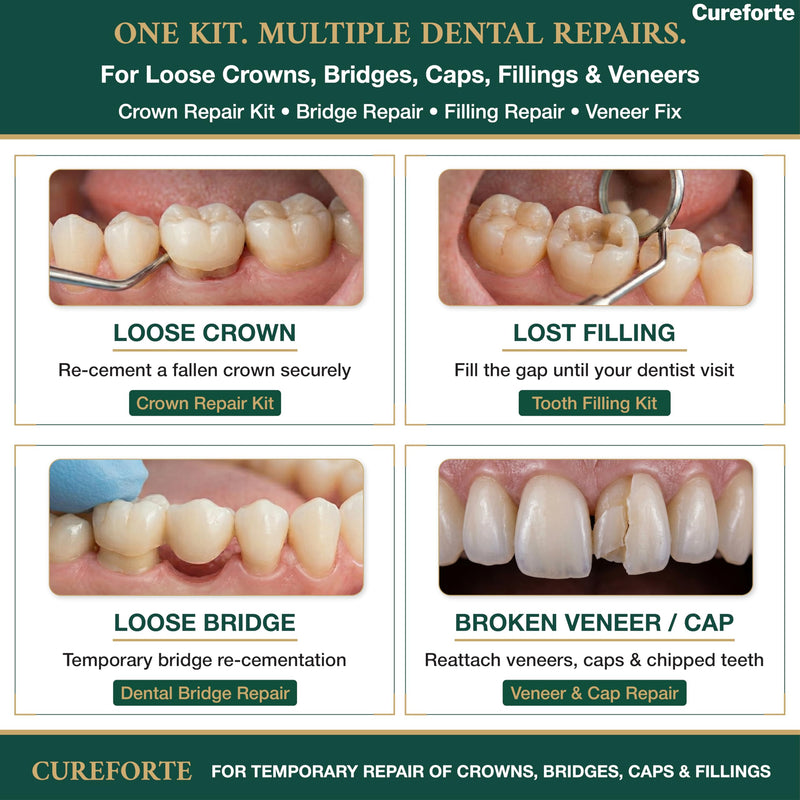 Zinc Oxide Eugenol Dental Cement Kit – Professional Temporary Crown & Bridge Glue for Tooth Fillings | Self-Curing, Strong Bond, and Pulp-Soothing Formula | Easy-to-Use Dental Repair Kit