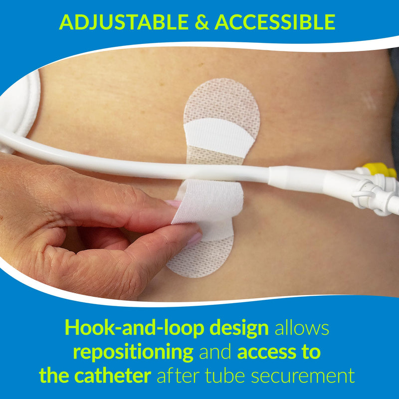 TIDI 3300M-10PK Grip-Lok Medium Securement Device ― Pack of 10 ― Catheter Stabilization Device ― White ― Flexible Material ― Low-Profile Design for Comfort― Home Healthcare ― Medical Supplies