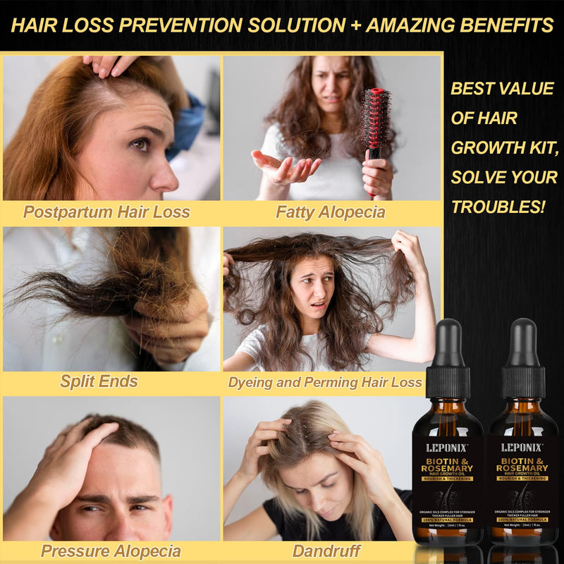 Rosemary Oil for Hair Growth, Diluted Rosemary Oil Hair Growth Serum with Derma Roller & Scalp Massager Hair Thickening Products Hair Loss Treatment for Men Women, Mens Gift Set 15 ml (Pack of 4)