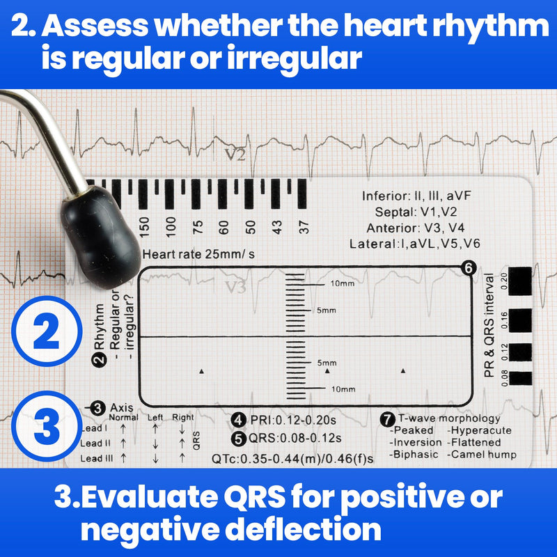 10pcs ECG 7 Step Ruler, Transparent EKG Calipers Ruler, Electrocardiogram Card Portable Plastic Measuring Tool for EKG Interpretation Clear-10pcs
