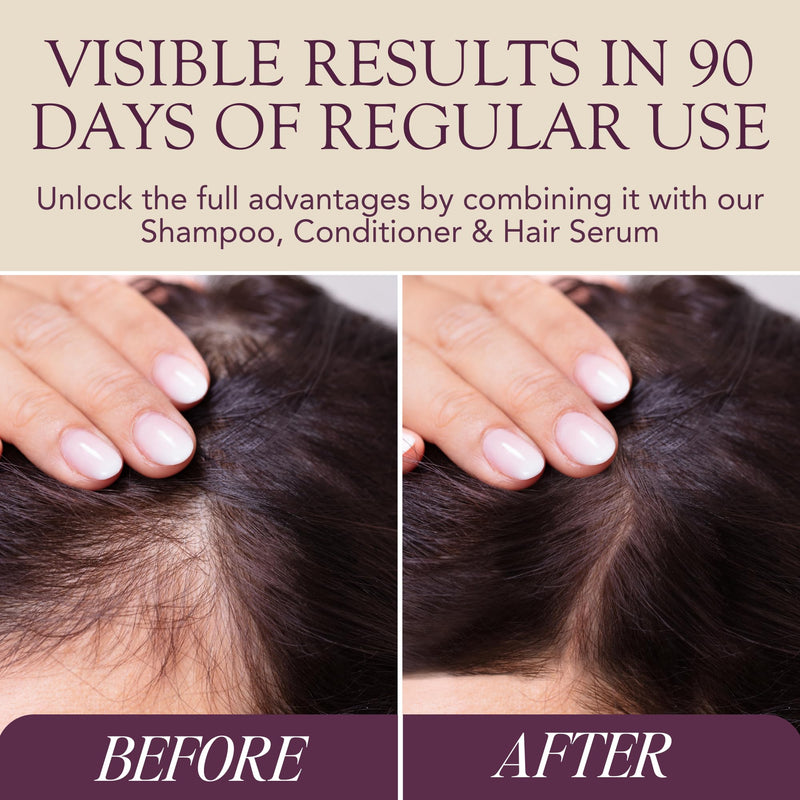 MEGI Wellness Hair Growth Vitamins for Women & Men - Biotin, Zinc, AnaGain | Hair vitamins for women & men with AnaGain, biotin, zinc, iron & more, 3rd party tested, supports regrowth and volume