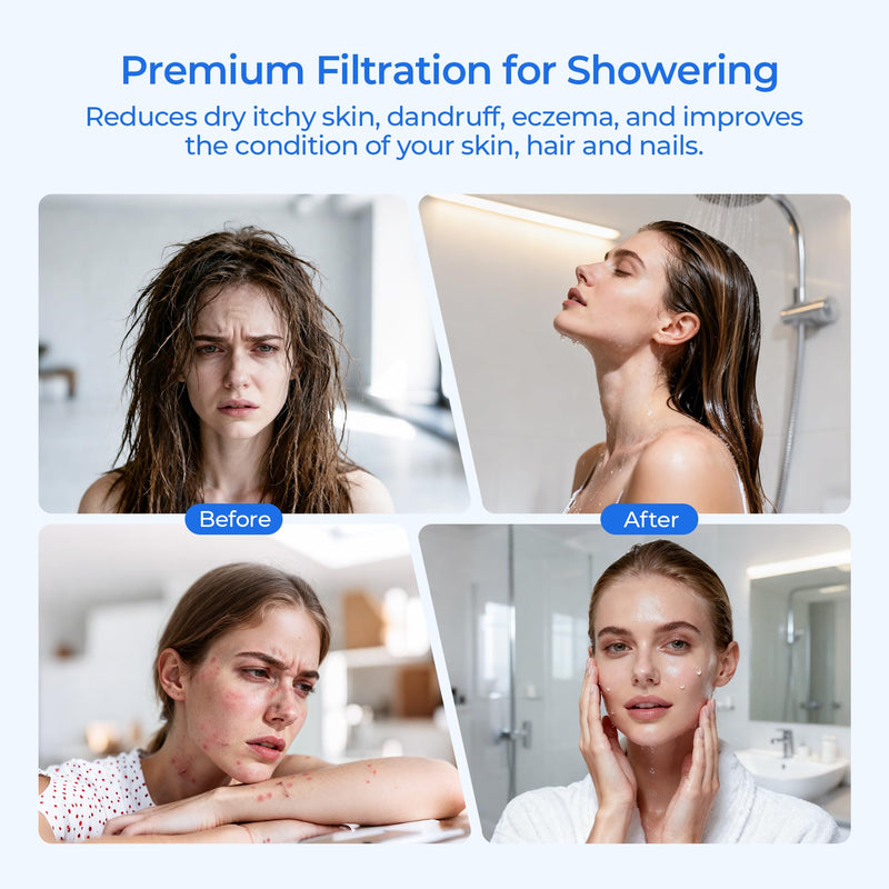 R24162-NA Showerhead Filter Replacement, Compatible with Kohler Aquifer Filtered Showerhead R24670 or Kohler Aquifer Shower Filter R24612, 2 Pack