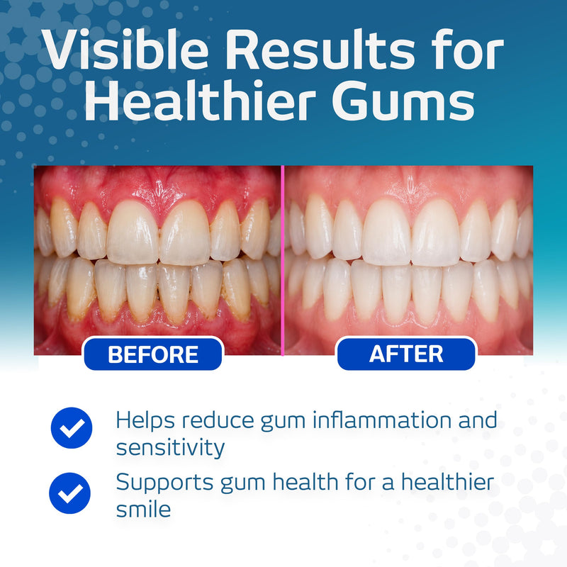 Vitis Gingival Mouthwash Panthenol Cetylpyridinium Chloride Zinc Alcohol-Free 500ml Mint Sensitive Gums
