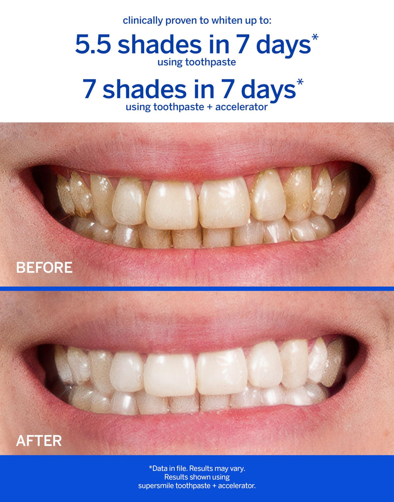 Supersmile Original Mint Fluoride-Free Whitening Toothpaste, 3.4 oz, TSA Approved Travel Size Toothpaste with Calprox®, Whitens 5.5 Shades in 7 Days, RDA 65 Low Abrasion, Enamel Safe for Veneers 3.4 Ounce (Pack of 1)