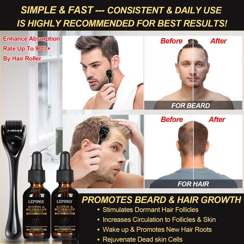 Rosemary Oil for Hair Growth, Diluted Rosemary Oil Hair Growth Serum with Derma Roller & Scalp Massager Hair Thickening Products Hair Loss Treatment for Men Women, Mens Gift Set 15 ml (Pack of 4)