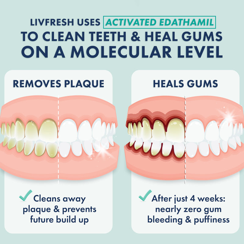 LIVFRESH Toothpaste Gel, Clinically Proven to Remove Plaque 250% Better, Improves Gum Health 190% Better, Prevents & Reduces Tartar, Freshens Breath, SLS Free Dental Gel, Wintergreen, 3 Pack Wintergreen, Foaming, Whitening 1.75 Ounce (Pack of 3)