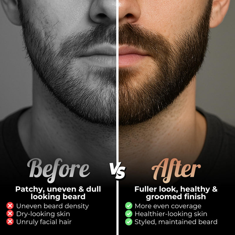 Red-Blooded Beard Roller, Derma Roller, Microneedling Roller, Beard Growth | Also called a dermaroller, this 0.5mm microneedle roller for hair growth supports thicker, fuller beard regrowth for men.