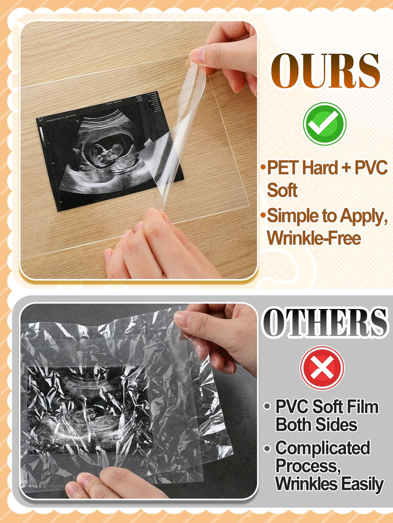 20 Sets User-Friendly Laminating Sheets for 3x4/4x6in Ultrasound Pictures | Keep Baby Sonogram Picture/Special Memories Safe, Pregnancy Journal Must Haves, Pregnancy Gifts for Expecting Mom