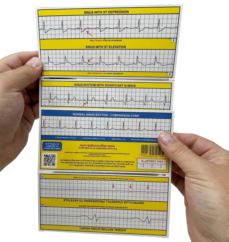 R-CAT for Arrhythmias EKG Pocket Reference Guide – Contains Literally Every EKG Rhythm Known - Great Study Booklet for EKG Interpretation - Cardiac Rhythm Interpretation Made Easy