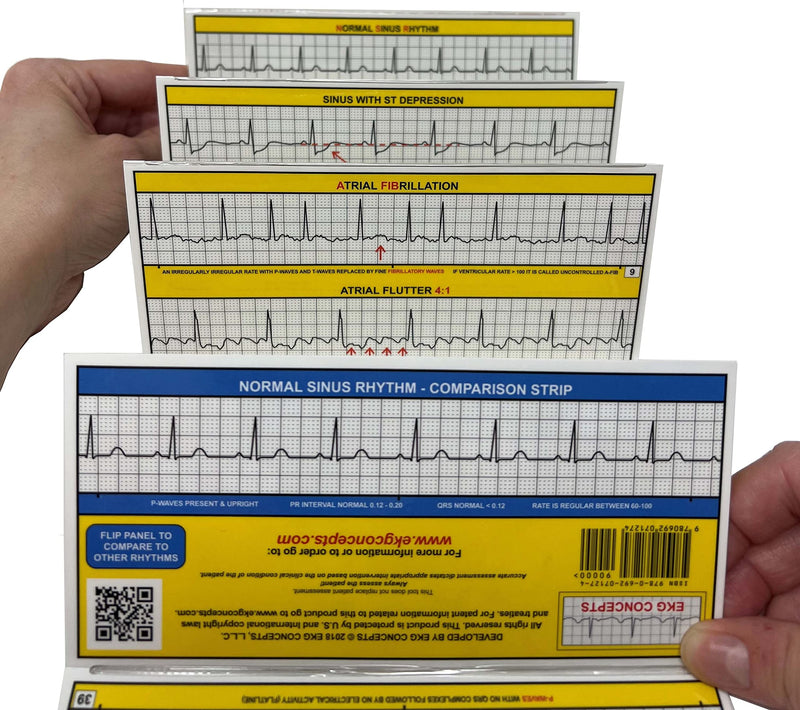 R-CAT for Arrhythmias EKG Pocket Reference Guide – Contains Literally Every EKG Rhythm Known - Great Study Booklet for EKG Interpretation - Cardiac Rhythm Interpretation Made Easy