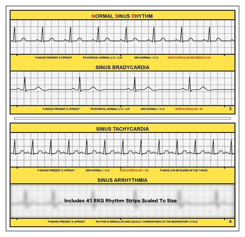R-CAT for Arrhythmias EKG Pocket Reference Guide – Contains Literally Every EKG Rhythm Known - Great Study Booklet for EKG Interpretation - Cardiac Rhythm Interpretation Made Easy