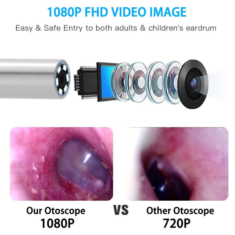 Ear Wax Removal Endoscope Otoscope, Earwax Remover Tools, Scope, with 1080P FHD Camera, 6 Led Lights, Wireless Connected, Compatible with iPhone, iPad, Android Smart Phones & Tablets, White - LeoForward Australia